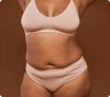 XL